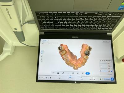 口腔内カメラ